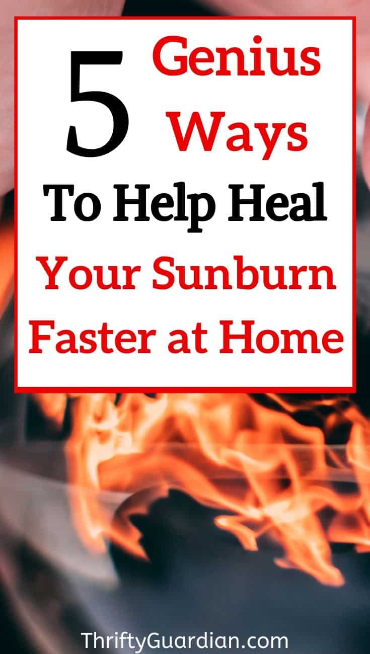 heal sunburn faster
